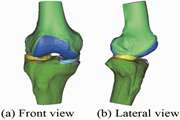 A multiscale phase field method for joint segmentation-rigid registration - Application to motion estimation of human knee joint